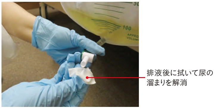 蓄尿バッグ 尿の捨て方ガイドライン