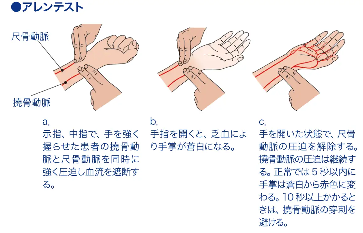 アレンテスト│看護師ライフをもっとステキに ナースプラス