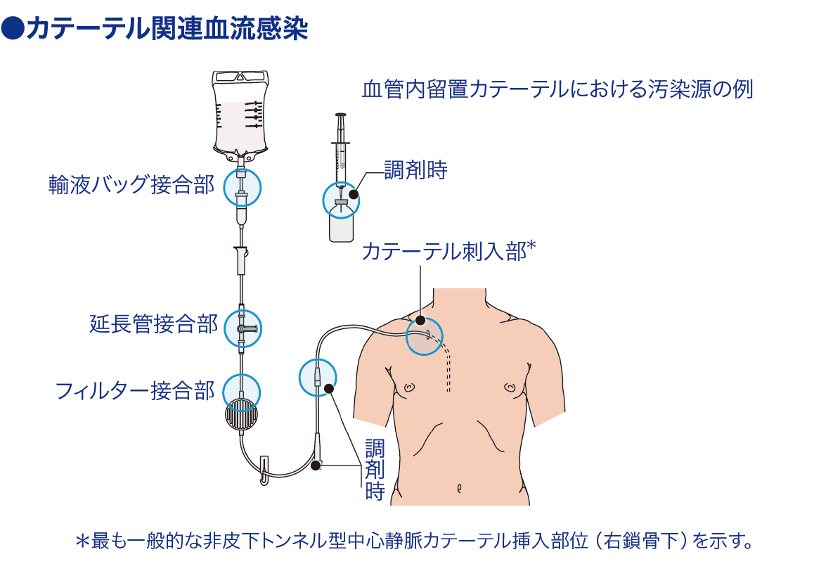 ハンド オーバー マウス 法