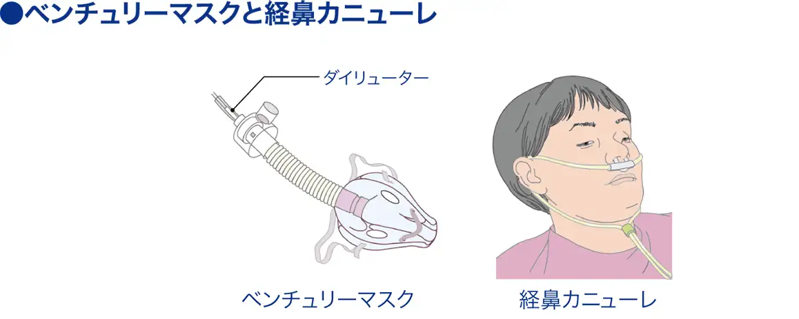 ベンチュリーマスク│看護師ライフをもっとステキに ナースプラス