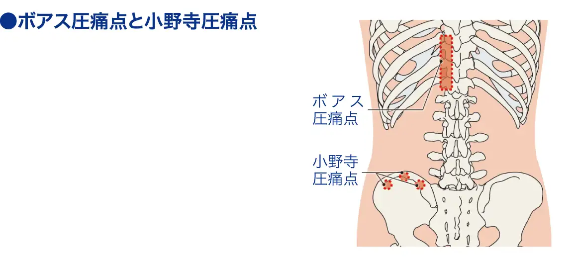 ボアス圧痛点│看護師ライフをもっとステキに ナースプラス