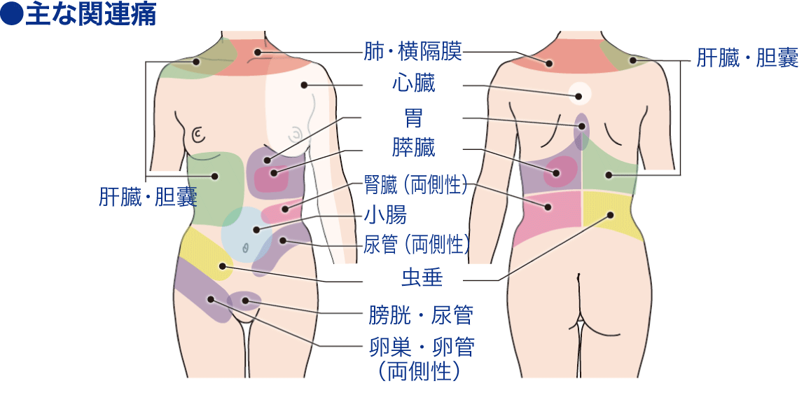 放散痛[関連痛]│看護師ライフをもっとステキに ナースプラス