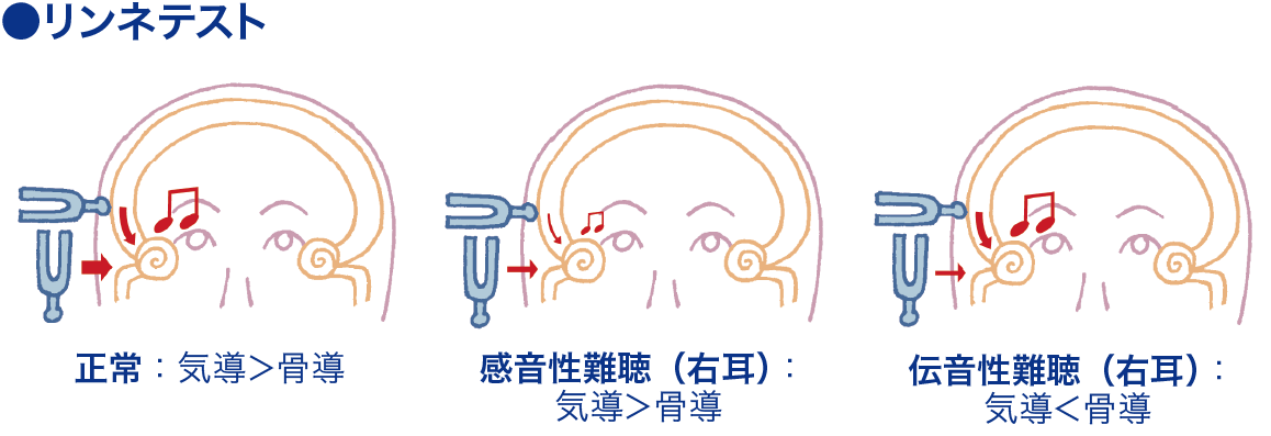 リンネテスト│看護師ライフをもっとステキに ナースプラス