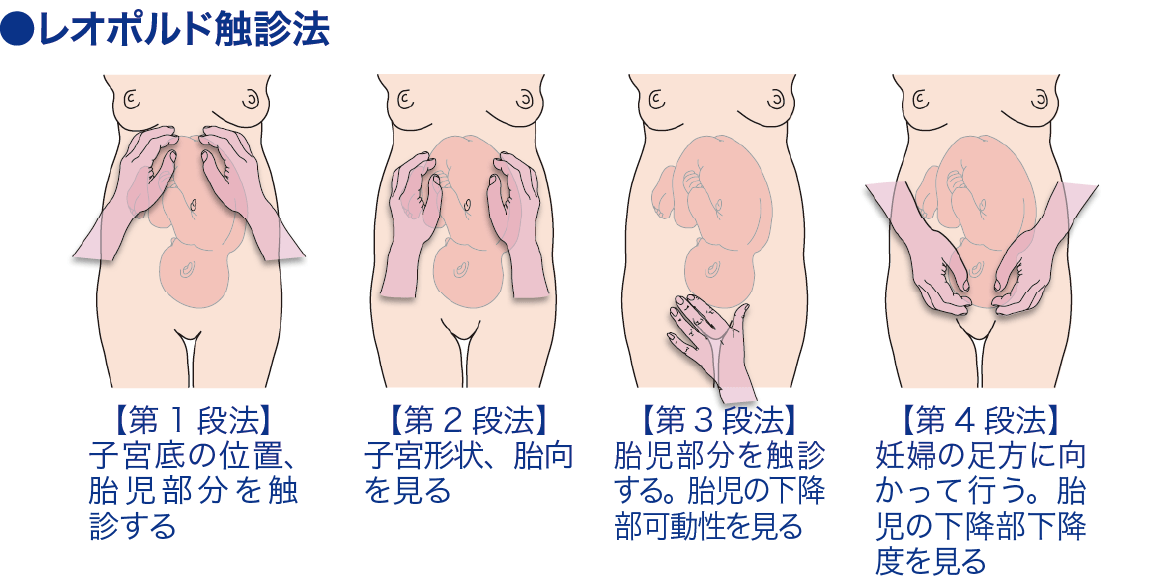 レオポルド触診法│看護師ライフをもっとステキに ナースプラス