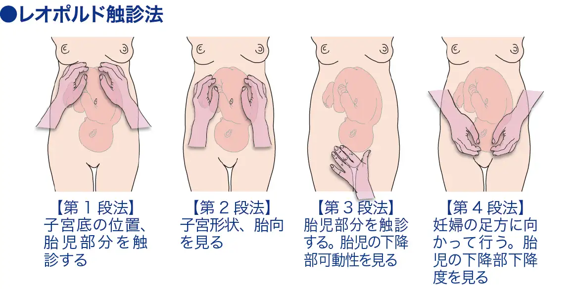 レオポルド触診法│看護師ライフをもっとステキに ナースプラス